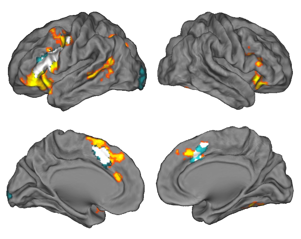 Miller Lab Research Summary